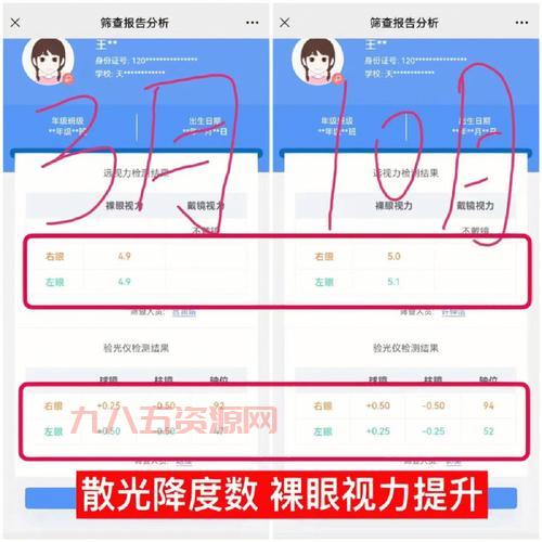 近视镜蚂蚁庄园：揭开近视眼镜的秘密