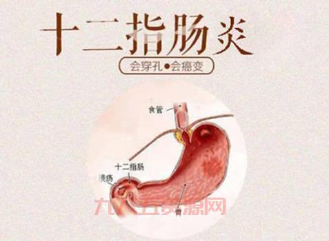 XXOO是什么？揭秘网络中的隐晦用语及其影响