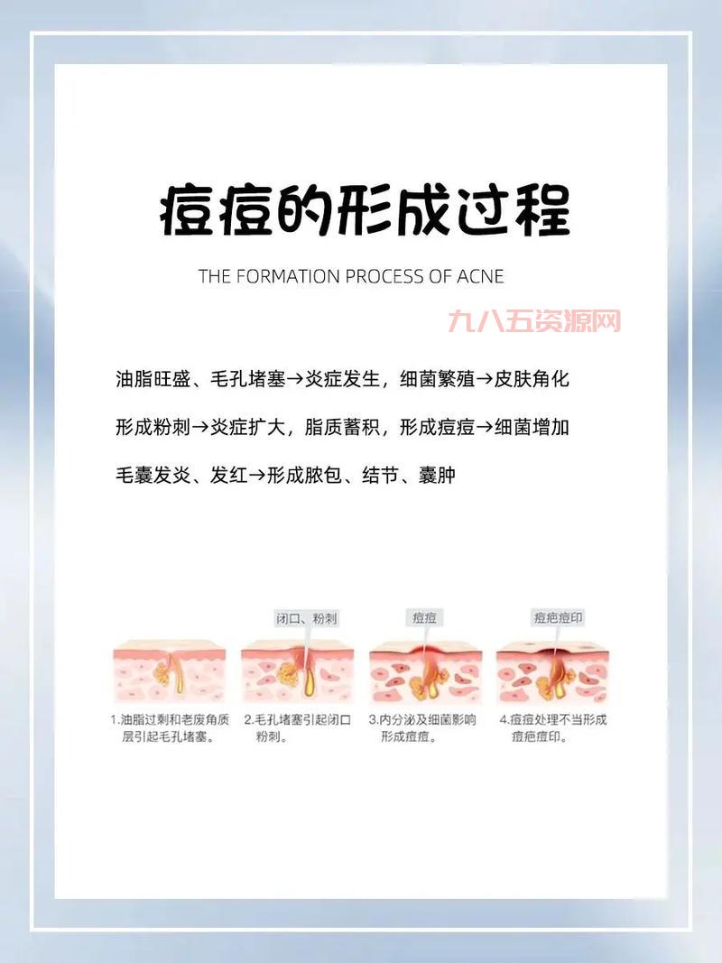 痘痘里到底是什么？深入解读痘痘成因和护理方法