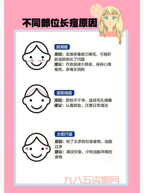 痘痘里到底是什么？深入解读痘痘成因和护理方法